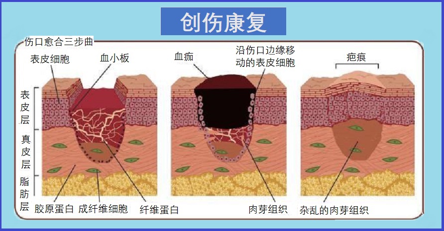  创伤与康复